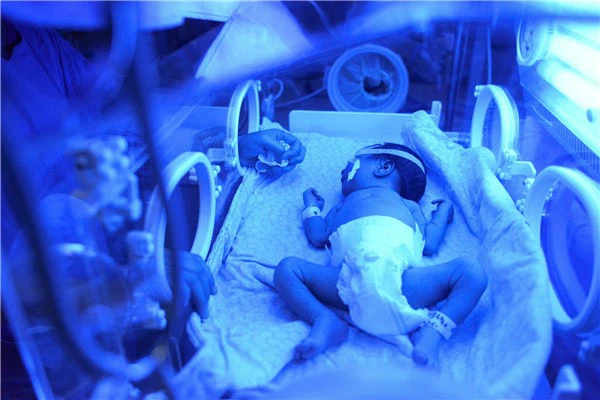 blue light for the new born babies blue light for the new born babies